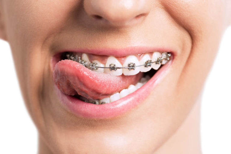 Services Offered by an Orthodontist in Morrisville