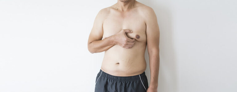 Choosing the Right Surgeon for Gynecomastia Treatment in Sioux Center, IA