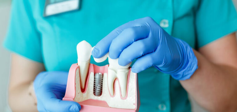Dental Implant- Prepare Yourself With These Tips!