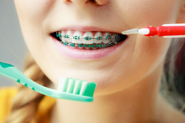The Art of Brushing with Braces: A Step-by-Step Guide in Los Gatos