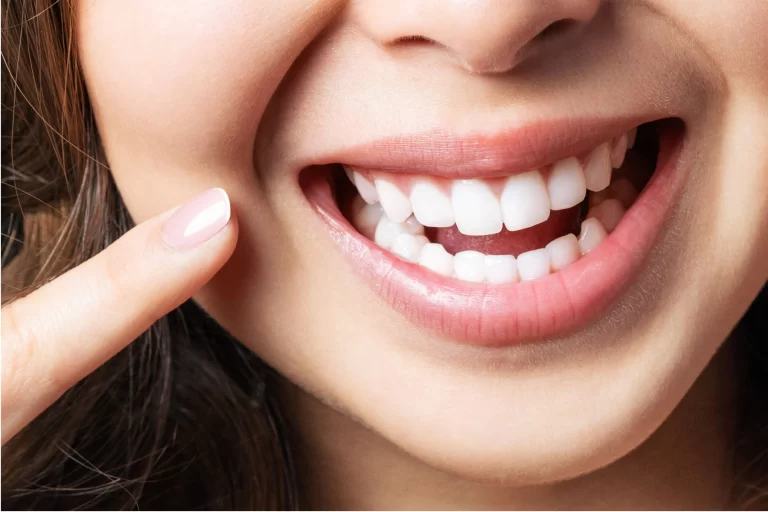 What are Top Foods for Stronger Teeth and Healthier Gums? 